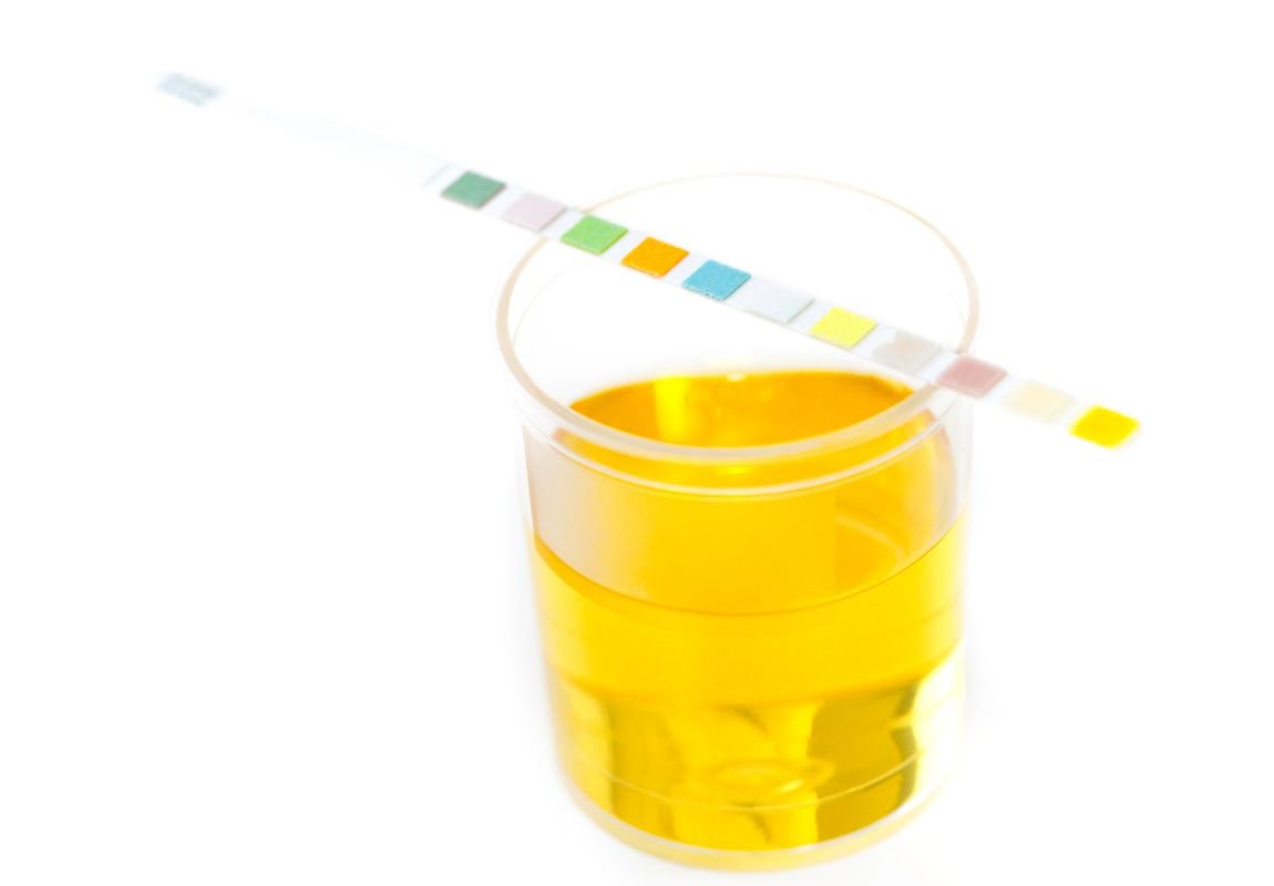 What Does My Pee Color Mean? 9 Types of Pee and Their Meaning - 9Pedia.com