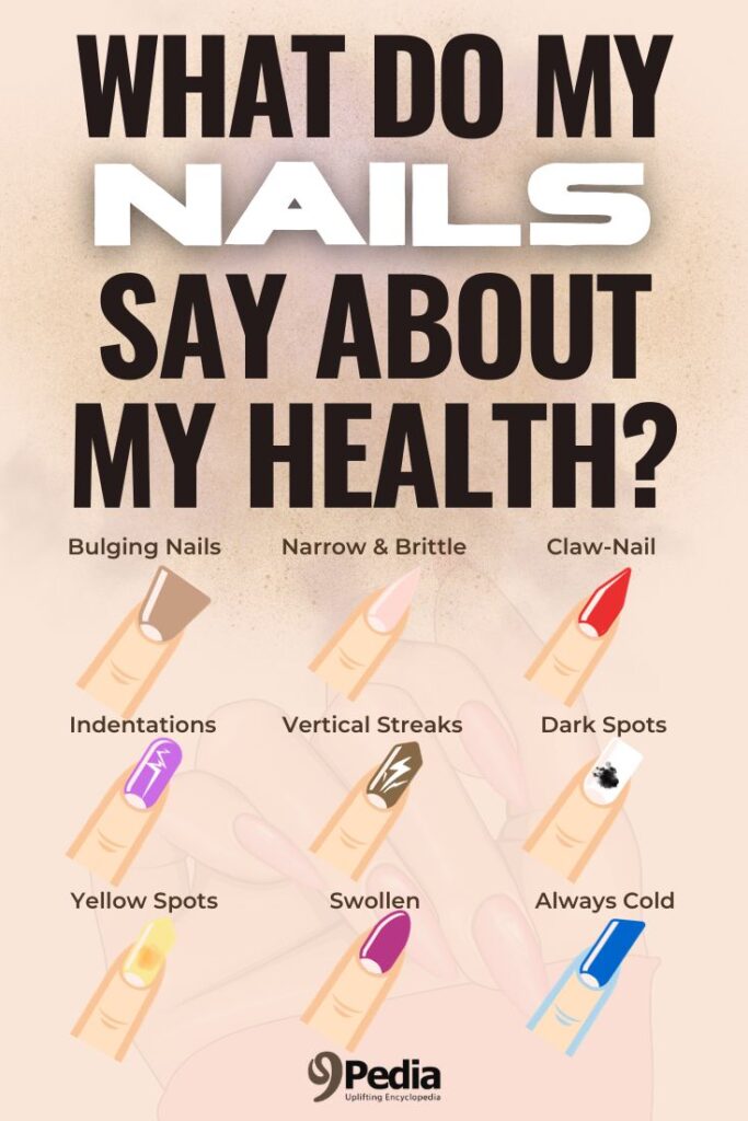 What Do My Nails Say About My Health? 9 Types of Nails and Their Meaning - 9Pedia.com