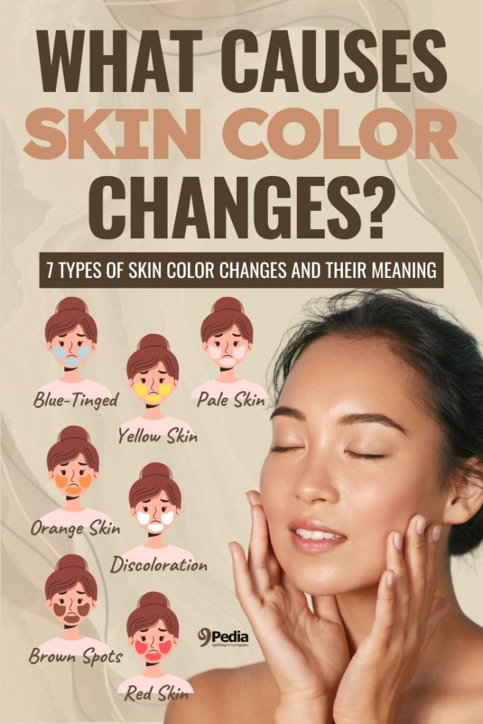 What Causes Skin Color Changes and What They Mean for Your Health - 9Pedia.com