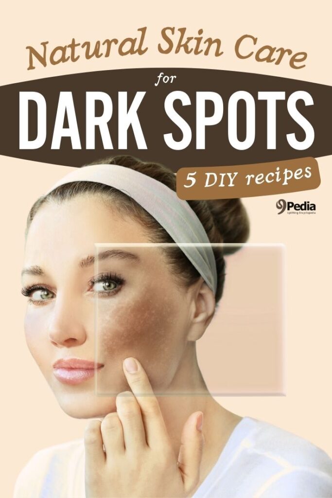 5 Natural Remedies for Dark Spots and Age Spots on Skin - 9Pedia.com