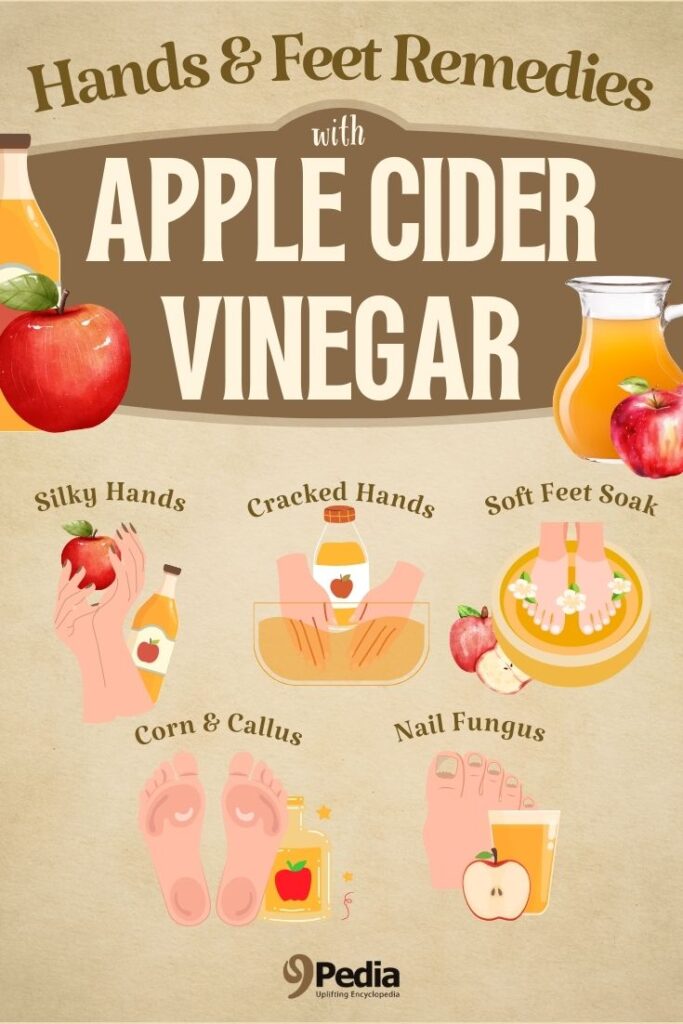 Apple Cider Vinegar for Hands and Feet: 5 Natural Home Remedies - Apple Cider Vinegar for Hands - 9Pedia.com